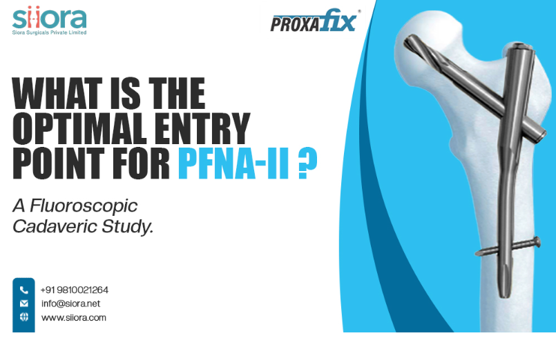 What Is the Optimal Entry Point for PFNA-II? A Fluoroscopic Cadaveric Study.