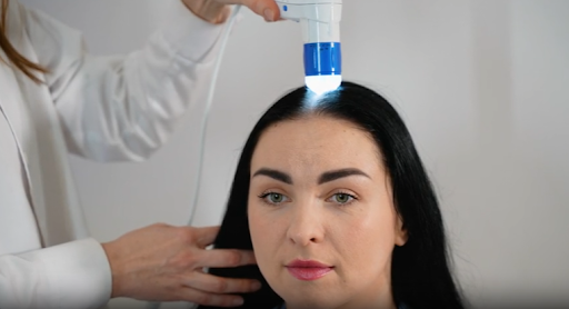 A New Era for Women’s Hair Restoration: Non-Surgical Solutions for Natural Results